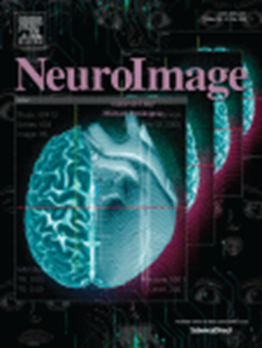 Resultados de projeto apoiado pela Fundação BIAL apresentados na revista “NeuroImage”