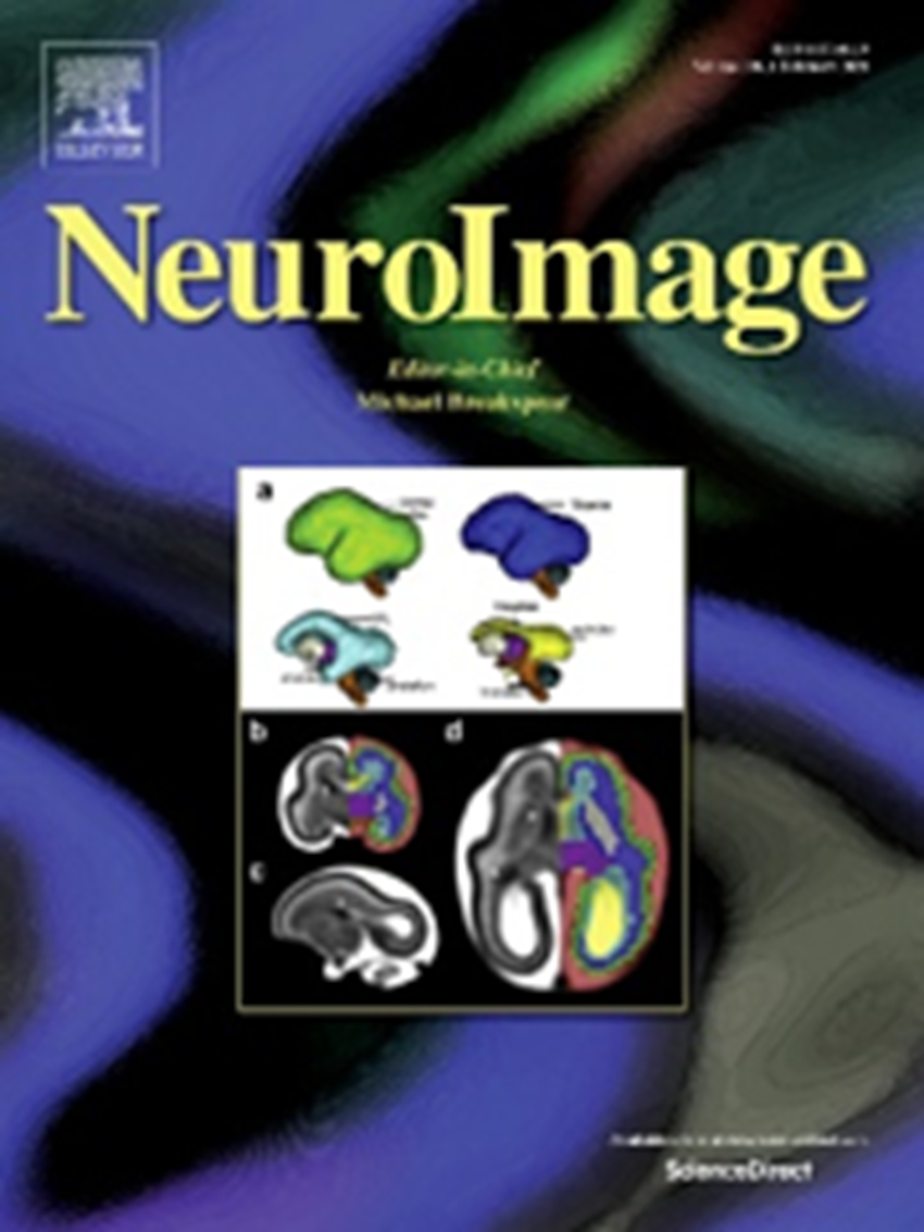 Resultados de projeto apoiado pela Fundação BIAL apresentados na revista “Neuroimage"