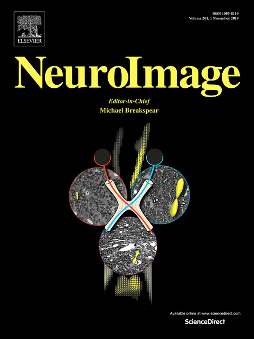 Research project supported by the BIAL Foundation published in Neuroimage (2)
